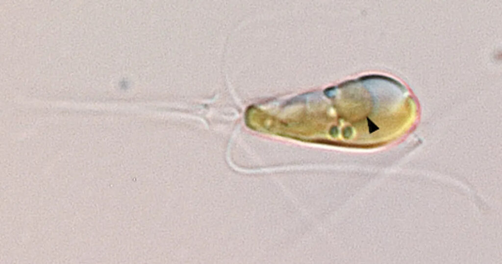 Το θαλάσσιο φύκι Braarudosphaera bigelowii έχει έναν λαθρεπιβάτη με τη μορφή του βακτηρίου UCYN-A, το οποίο έχει εξελιχθεί σε οργανίδιο (βέλος) εντός του κυττάρου του φυκιού